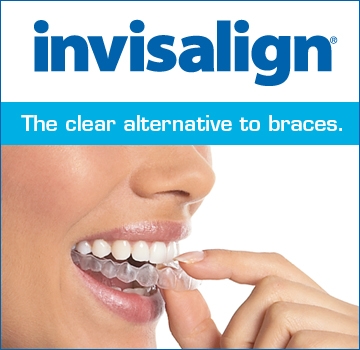 invisalign-clear-braces