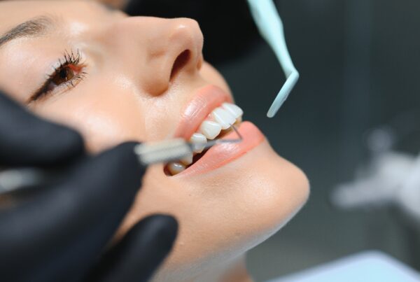 4 Cosmetic Dental Treatments for Discolored Teeth