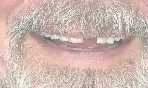 a close up of a man with a beard and a mustache