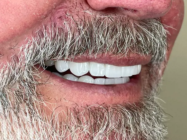 there is a man with a beard and a mustache with a toothbrush