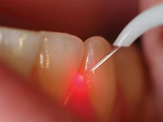 a close up of a person holding a tooth brush with a red light on it