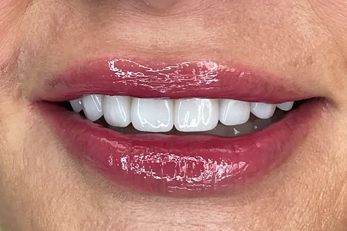 a close up of a woman ' s mouth with a white toothbrush
