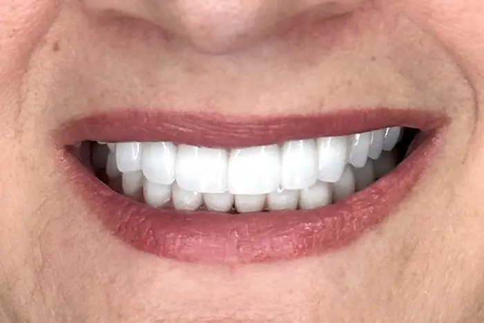 a close up of a person ' s mouth with a missing tooth