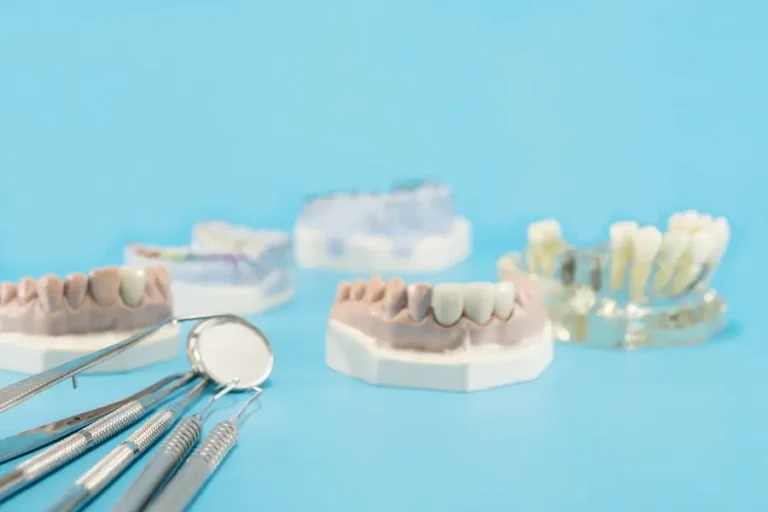 What to Do If Your Dental Crown Feels Loose: Shoreline Dental Studio