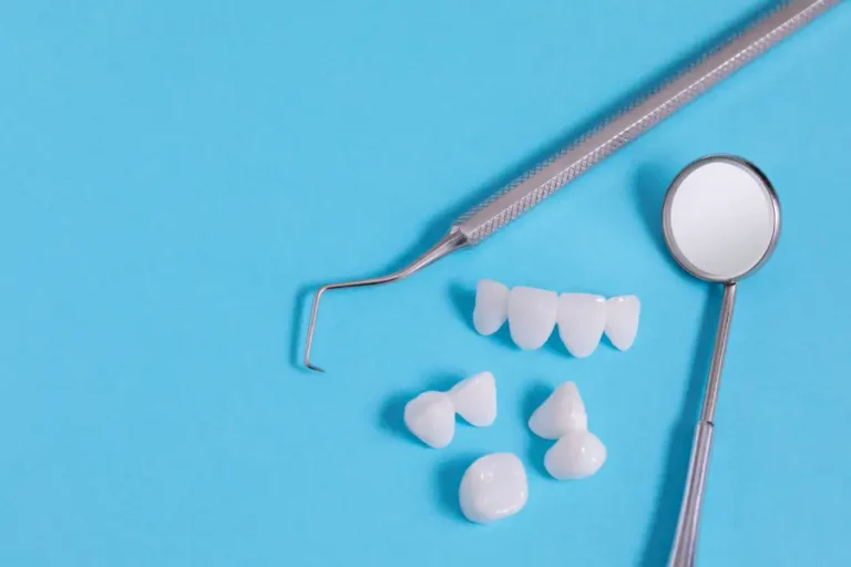 What to Do If Your Dental Crown Feels Loose: Shoreline Dental Studio