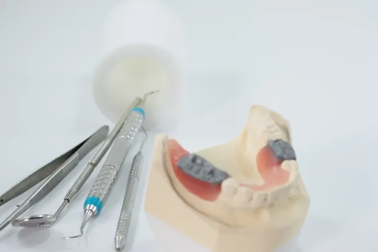 What to Do If Your Dental Crown Feels Loose: Shoreline Dental Studio