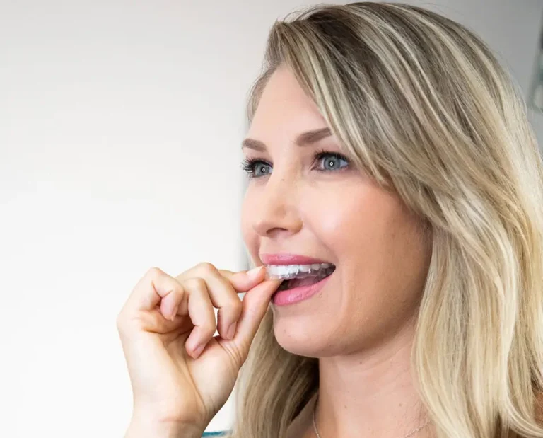Accelerated Invisalign®: Straighter Teeth in Half the Time