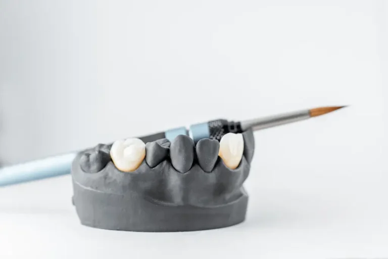 Dental crown model showing individual teeth prepared for restoration, with a dental brush resting on top.