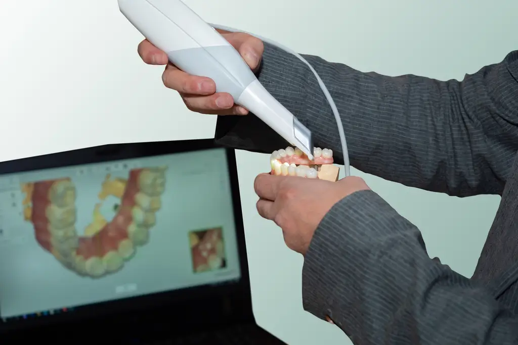 Dentist using an intraoral scanner on a dental model while digital 3D images of teeth appear on a laptop screen.