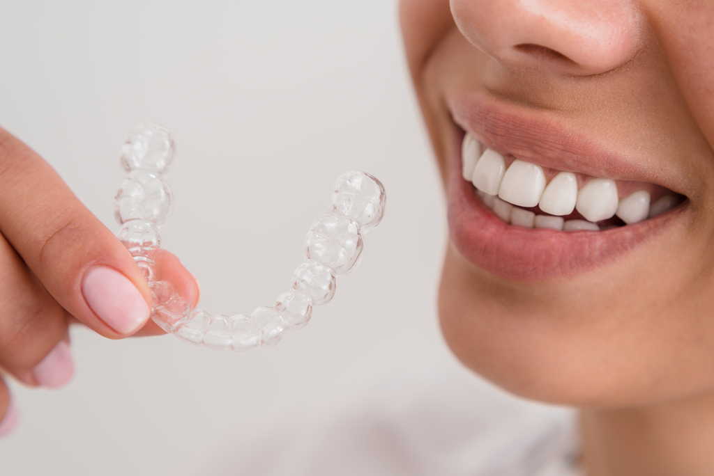 Smiling woman holding a clear Invisalign aligner in front of her teeth.