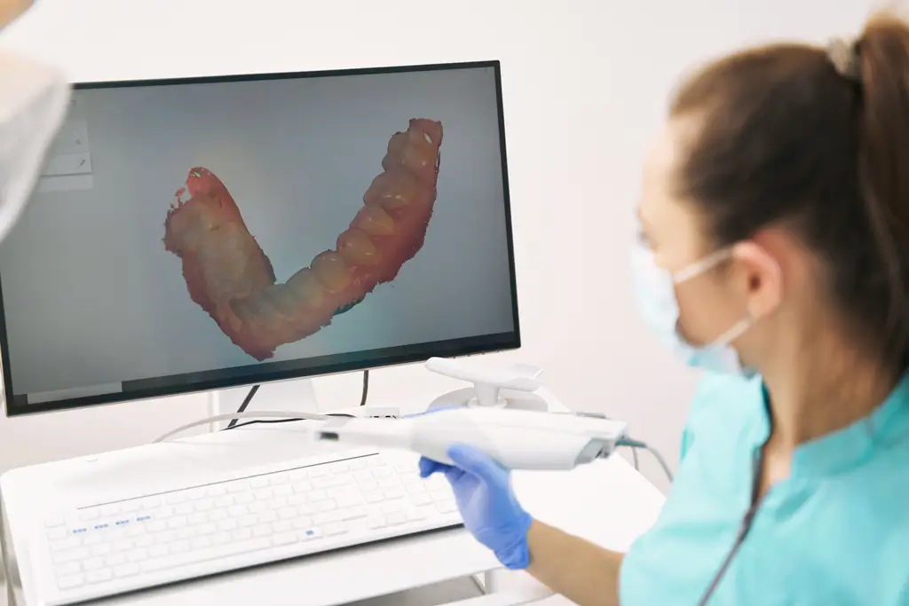 Dental hygienist using an intraoral scanner while a 3D digital model of teeth displays on the computer screen.