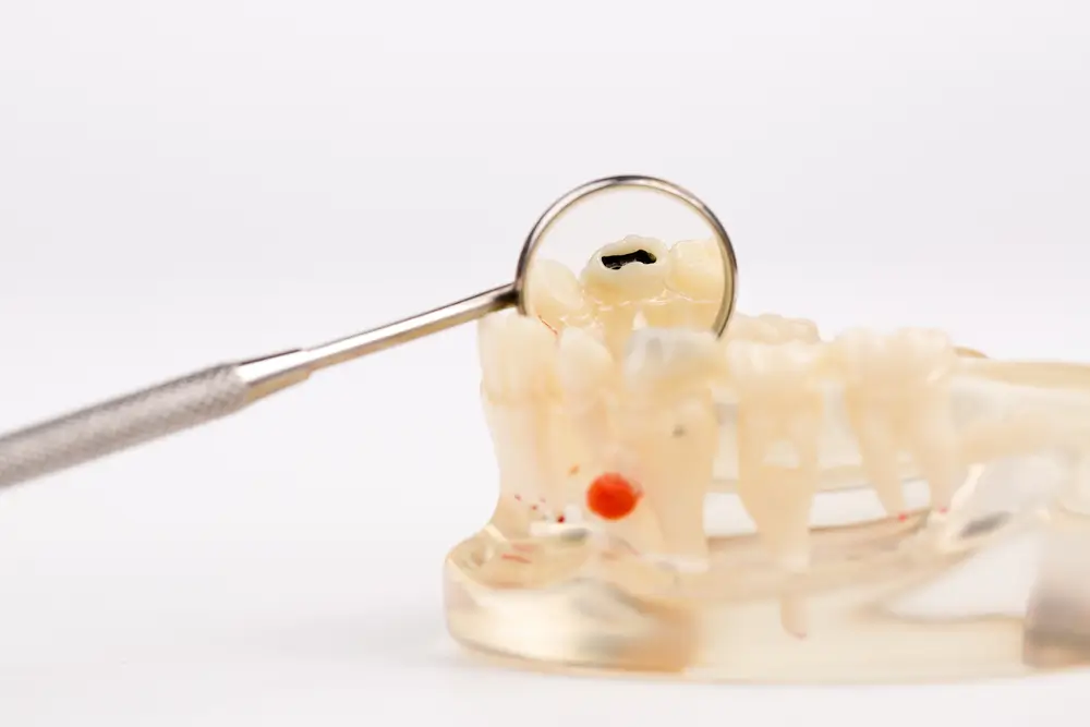 What to Do If Tooth Pain Fades Suddenly