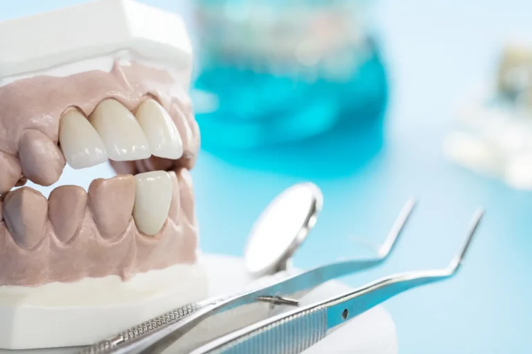 Do Your Crowns Need to Be Replaced? Signs to Watch For